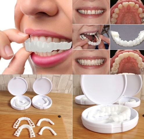Carillas HappySmile dentales