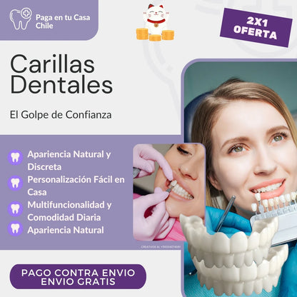 Carillas HappySmile dentales
